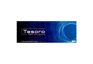 Tesoro Deep