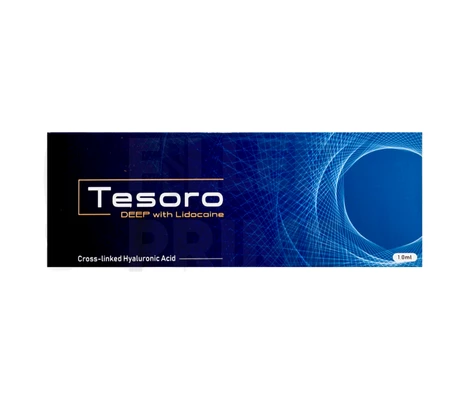 Tesoro Deep