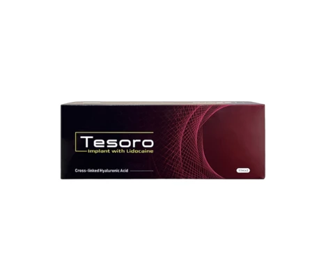 Tesoro Implant